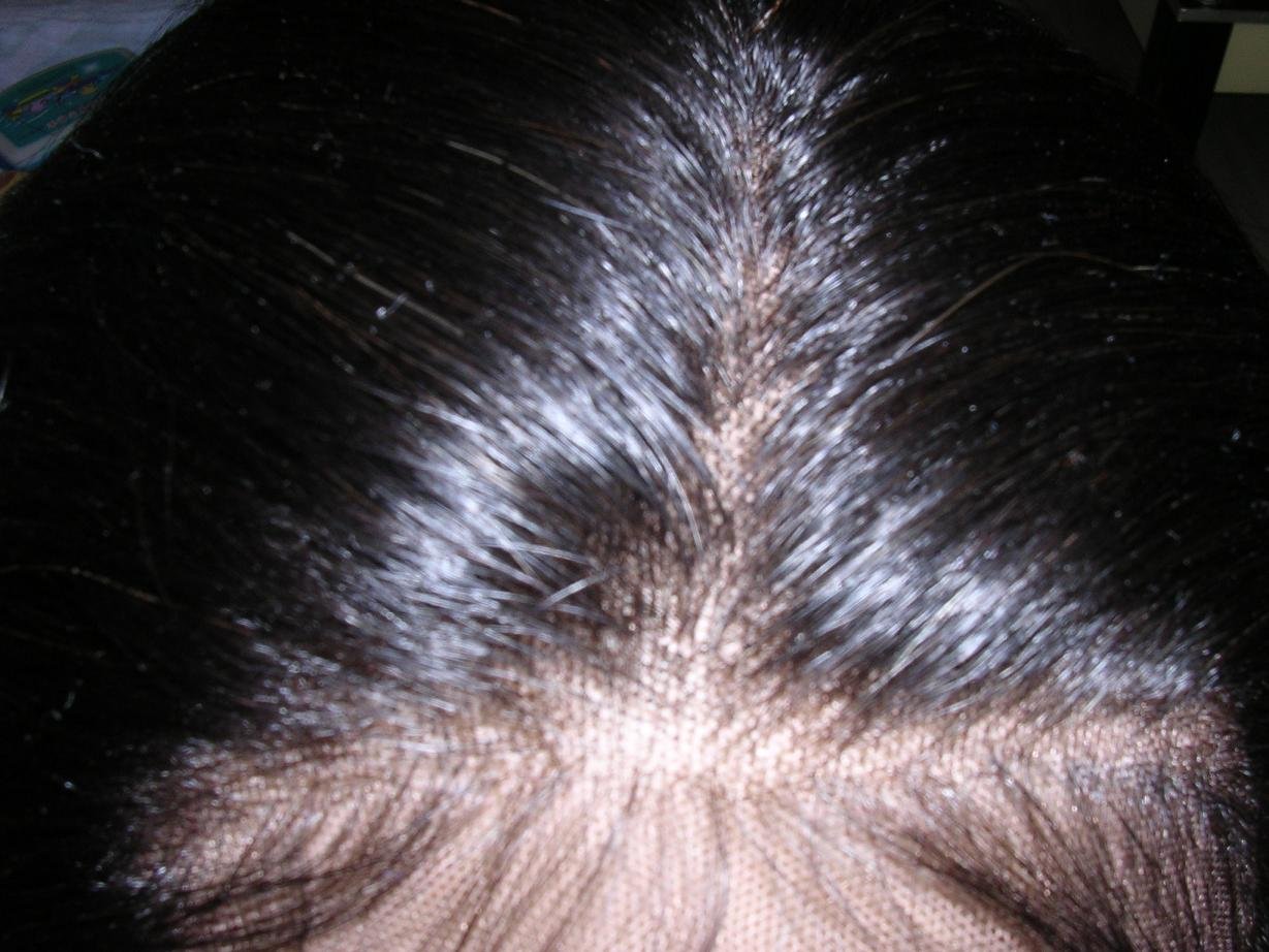full lace wig scalp and knot.JPG